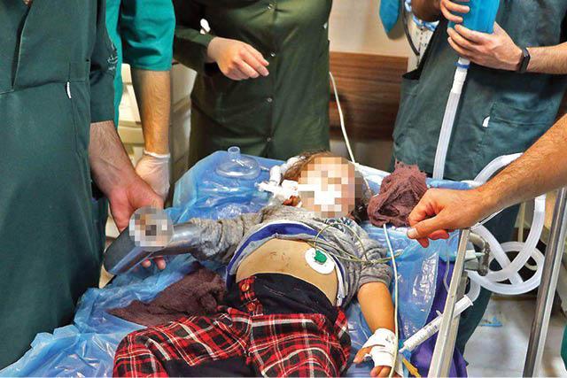 چرخ گوشت انگشتان کودک مشهدی را بلعید چرخ گوشت انگشتان کودک مشهدی را بلعید