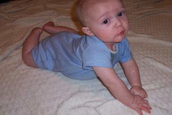 سندروم سر تخت (صاف) در نوزادان چیست؟