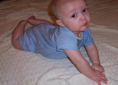 سندروم سر تخت (صاف) در نوزادان چیست؟
