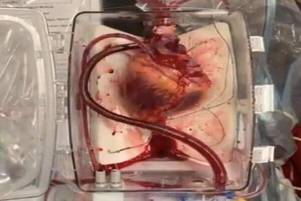محققان کشور برای سلول های تپنده قلب بستر زیست مهندسی شده ساختند